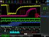 KEYSIGHT TECHNOLOGIES P9240BDLA-1FP